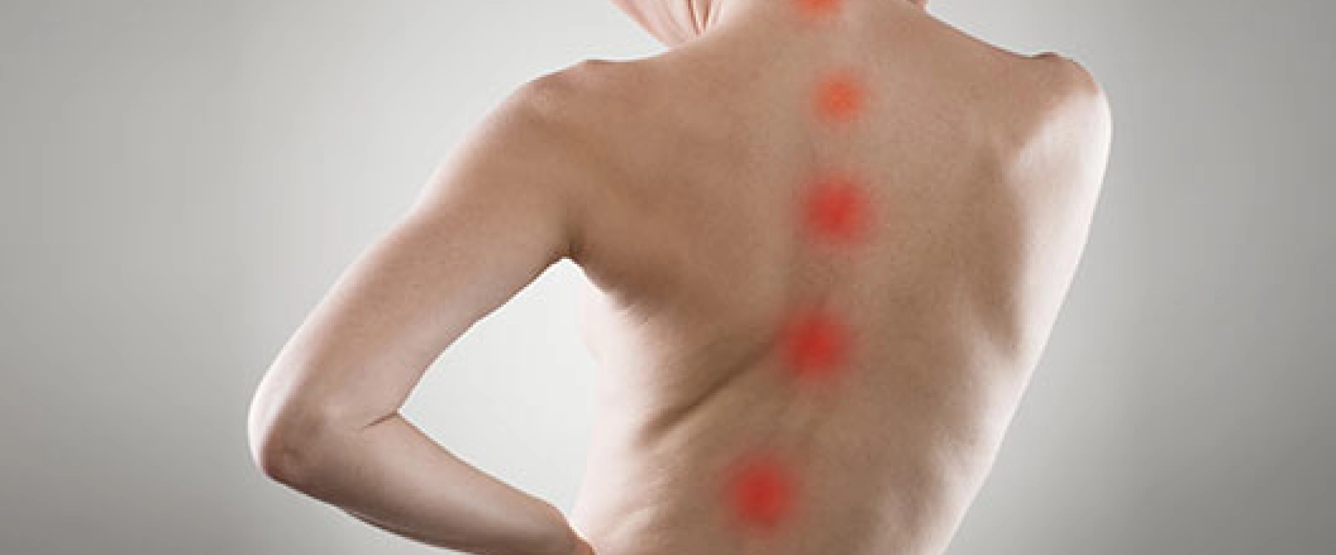 Scoliosis