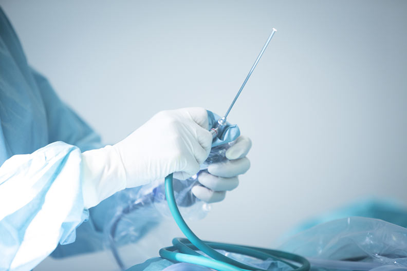 Endoscopia da Coluna
